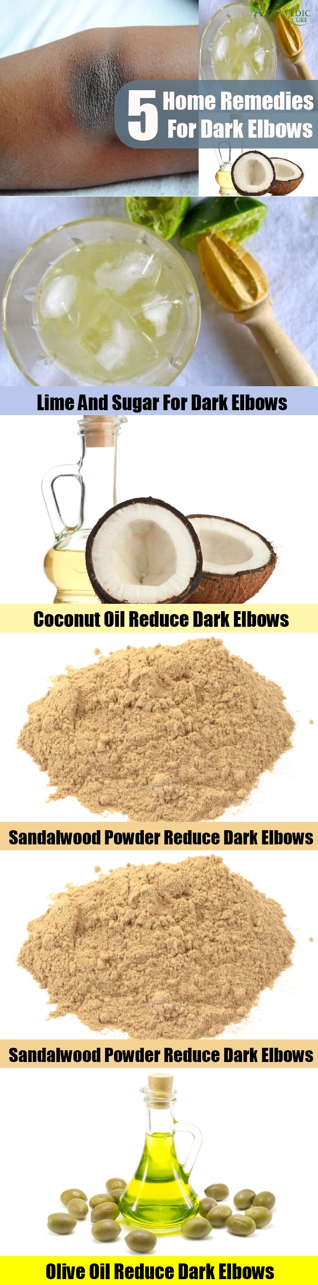 5 Amazing Home Remedies For Dark Elbows