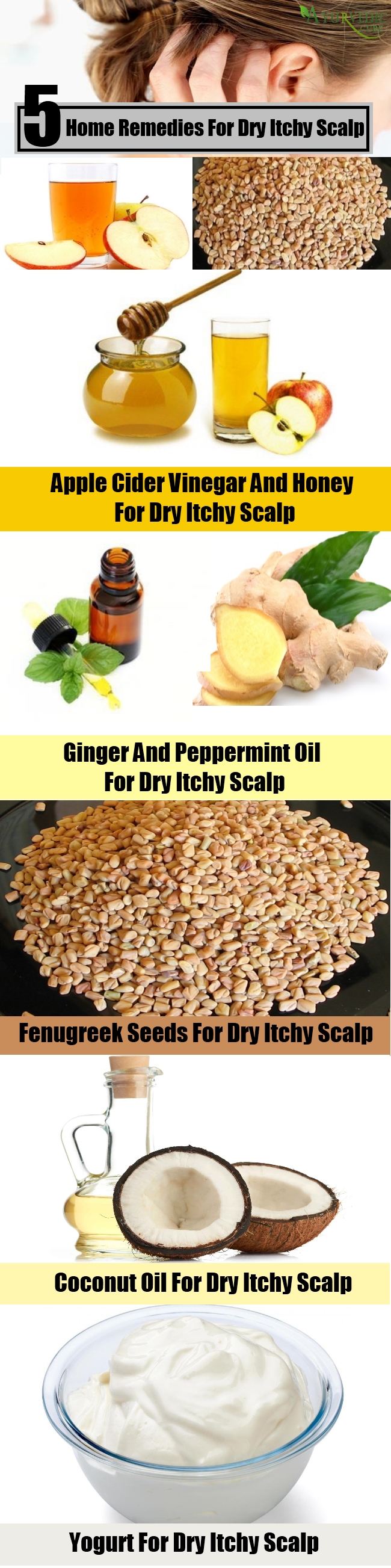 5 Home Remedies For Dry Itchy Scalp