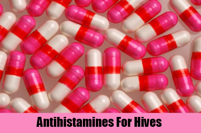 Antihistamines For Hives
