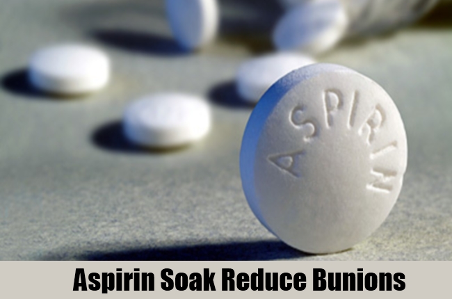 Aspirin Soak Reduce Bunions