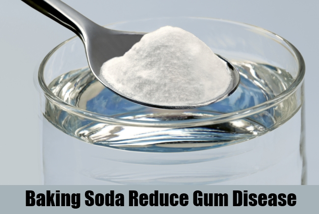 Baking Soda Reduce Gum Disease