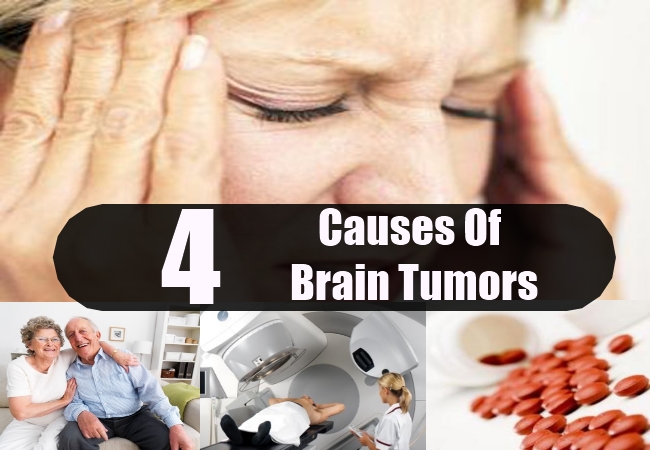 Causes Of Brain Tumors