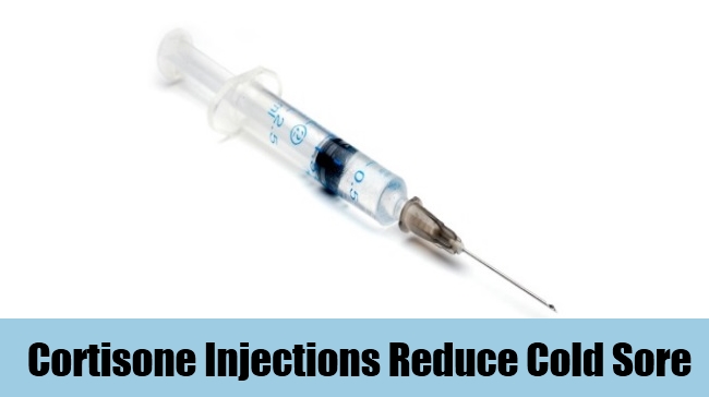 Cortisone Injections Reduce Cold Sore