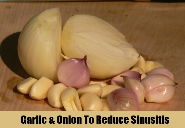 Garlic & Onion To Reduce Sinusitis