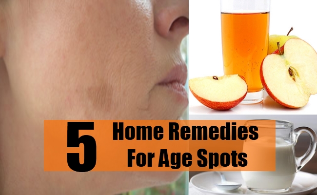 Home Remedies For Age Spots