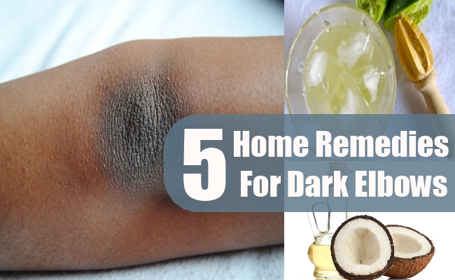 Home Remedies For Dark Elbows