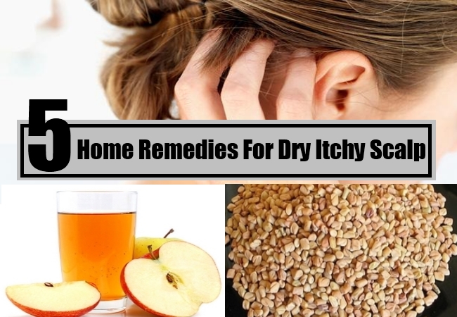 Home Remedies For Dry Itchy Scalp