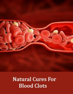 5 Ways On How To Treat Blood Clots | AyurvedicCure.com