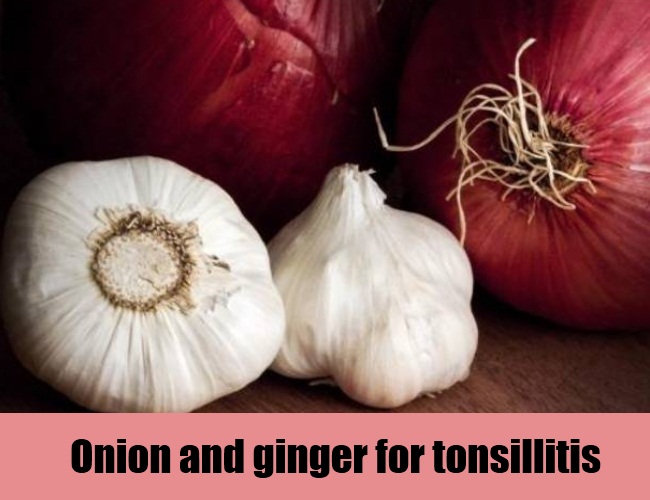 Onion & Ginger For Tonsillitis