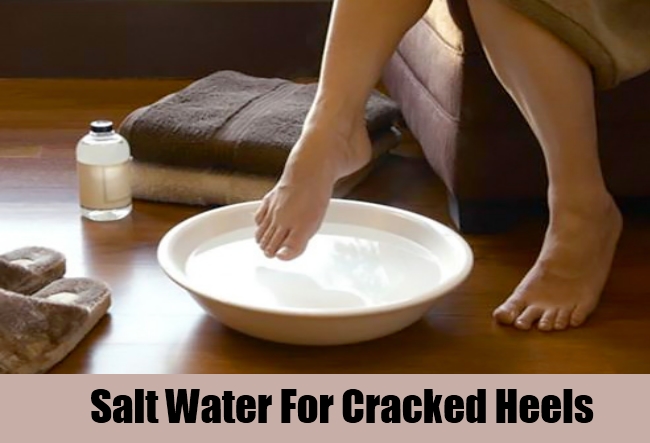 Salt Water For Cracked Heels