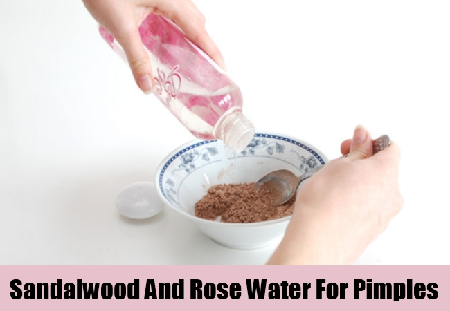 Sandalwood And Rose Water For Pimples