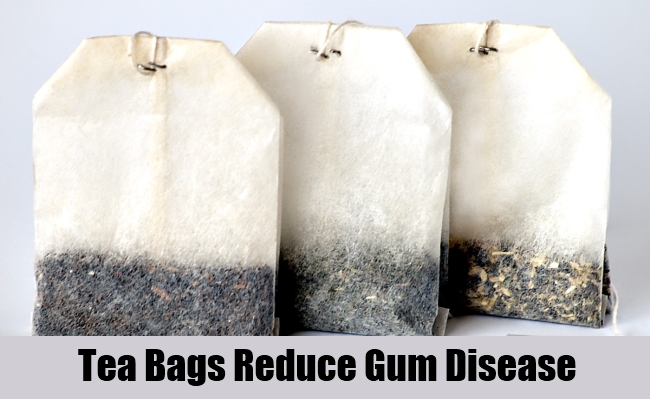 Tea Bags Reduce Gum Disease