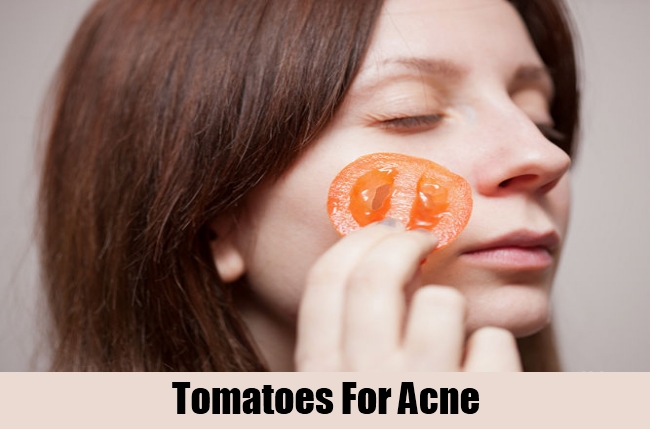 Tomatoes For Acne