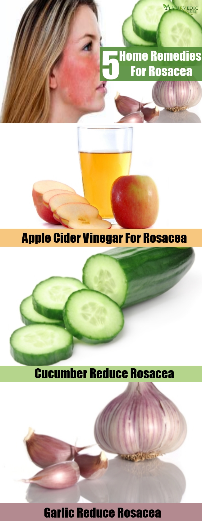 Top 5 Home Remedies For Rosacea - Natural Treatments And Cures ...