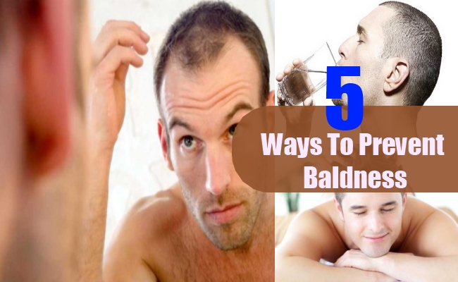 Ways To Prevent Baldness