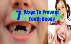 How To Prevent Tooth Decay - Effective Ways To Prevent Tooth Decay ...